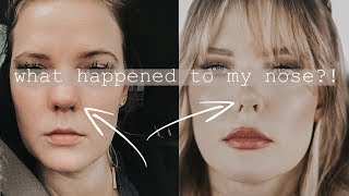 THE STORY OF MY NOSE | Addressing internet hate about me and my nose // @ImMalloryBrooke