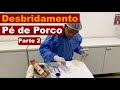 Desbridamento em pé de porco - Parte 2