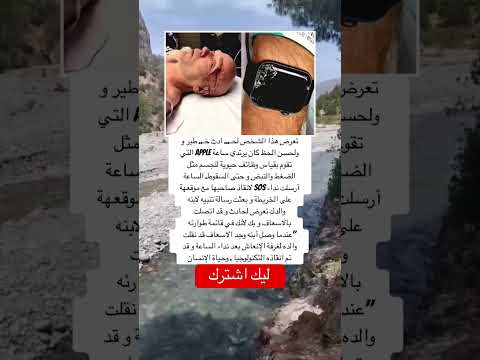 تعرض هذا الشخص لح ادث خ طير و ولحسن الحظ كان يرتدي ساعة  اكسبلور اقنباسات