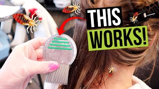 Lice Combing Techniques  How to Comb Lice out of Your Hair