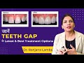 जानें Teeth Space | Dental Gap के Latest & Best Treatment Options | Usha Smile Care Dental Clinic