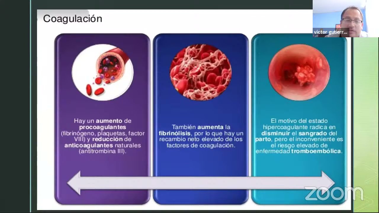 SHOCK HEMORRAGICO EN OBSTETRICIA - YouTube