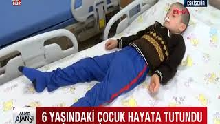 Eskişehirde Balkondan Düşen 6 Yaşındaki Mohammed, 23 Gün Sonra Hayata Tutundu Ahaber