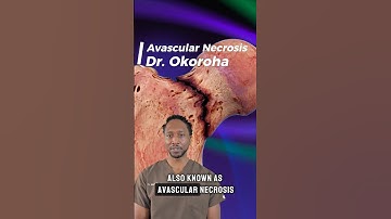 💡Hip Avascular Necrosis (AVN): How Core Decompression Helps🦵🏽#shorts