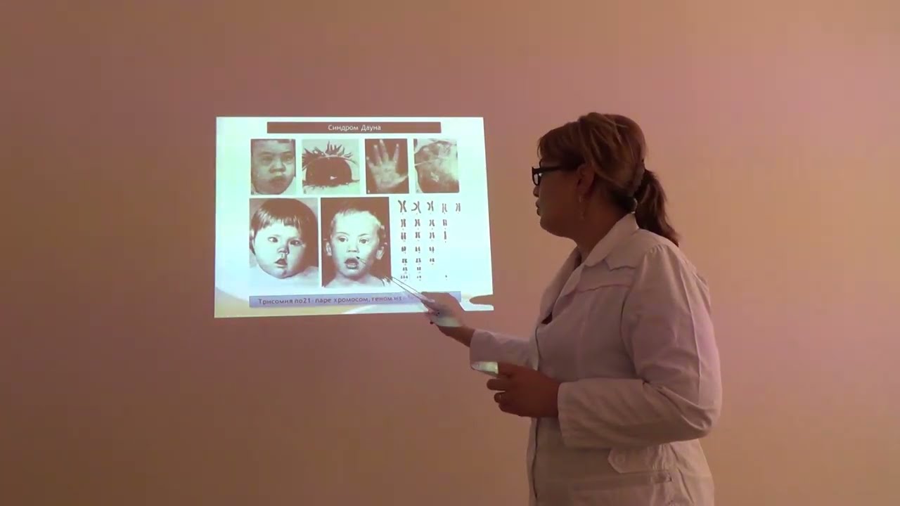 Xromasoma kasalliklari: klassifikatsiyasi, klinikasi, tekshirish usullari.