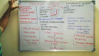 Trigeminal neuralgia - definition, classification, etiology, clinical features, diagnosis