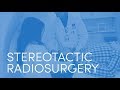 What to Expect - Stereotactic Radiosurgery