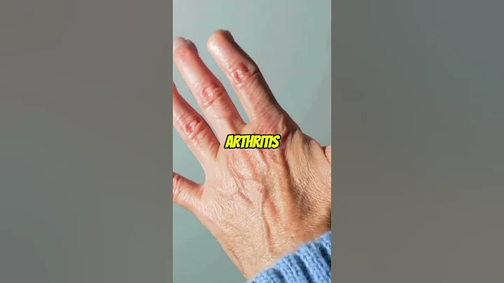 The #1 best vitamin for arthritis relief (Most people don’t know this) #food #healthtips #nutrition