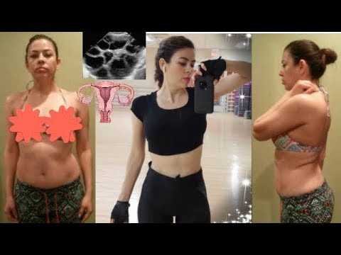 Ovarios poliquisticos dieta vegetariana