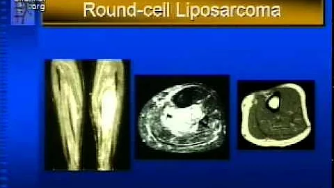 Tumors and Related Conditions Part 1