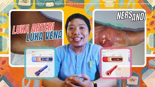 Ini Bedanya Luka Arteri dan Luka Vena #lukavena #lukaarteri #perawatanluka