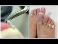 Most Satisfying Pedicure Transformation 😱 best nail polish for toes 2021