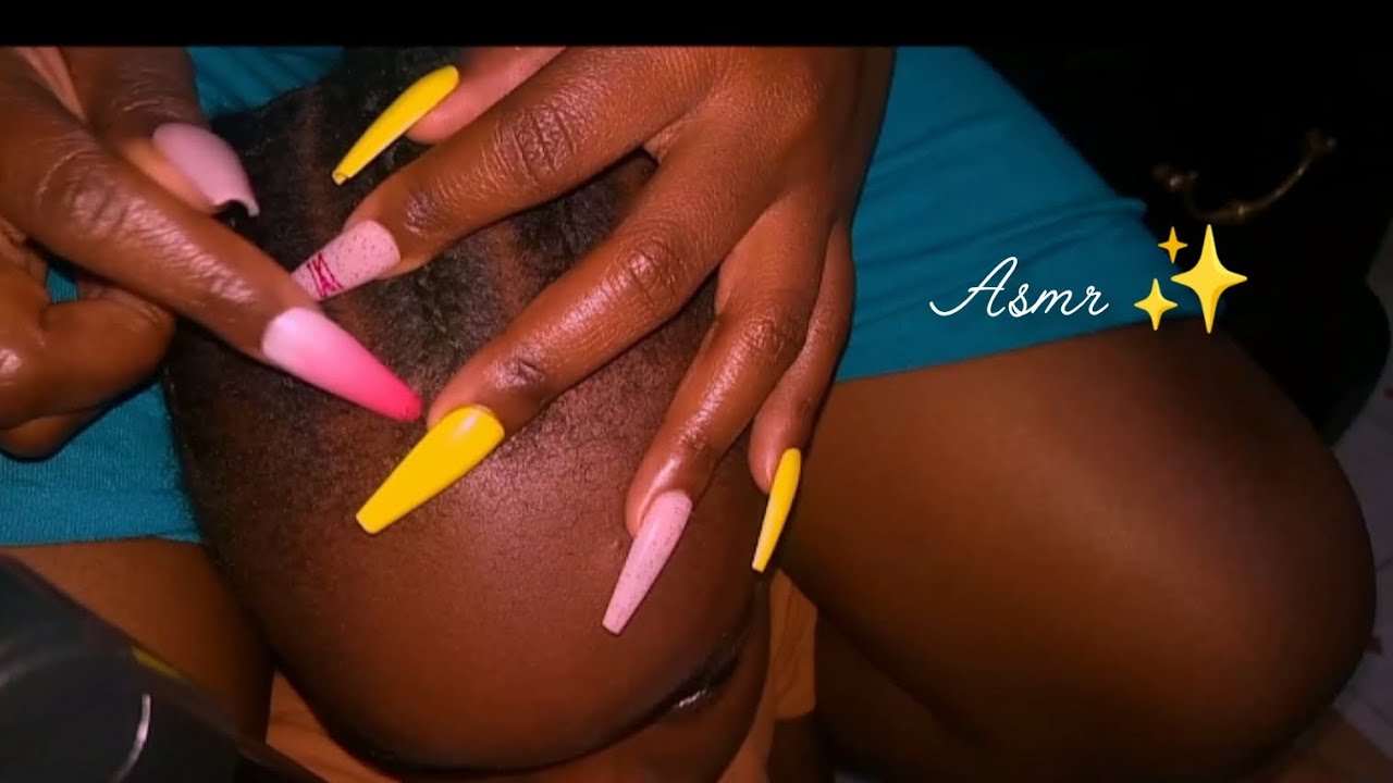 Long Nail Scalp Scratching and Nitpicking ASMR ✨