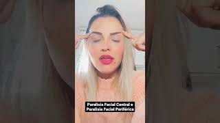 Tipos De Paralisia Facial  Fonovim Fonologia Neurolgica  Viviane Marques
