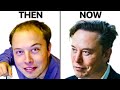 Elon musks hair transplant  surgeon reacts