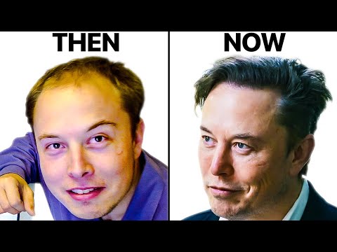 Elon Musk Before & After Hair: Everything You Need To Know!