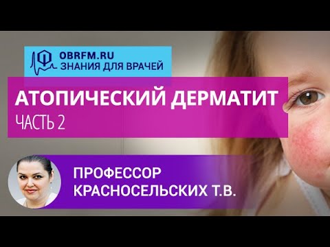 Профессор Красносельских Т.В.: Атопический дерматит. Часть 2