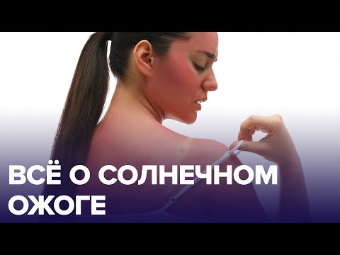 Как избежать СОЛНЕЧНОГО ОЖОГА? | Доктор 24