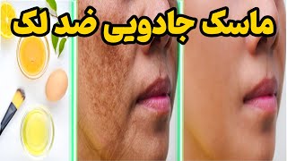 درمان یک شبه لکه های پوستی صورت : ماسک سفید کننده صورت فوری که لکه بر صورت نمیگذارد screenshot 5