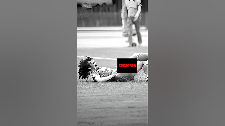 A PIOR LESÃO DA HISTÓRIA DO FUTEBOL!😳