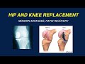 Modern Advances in Hip and Knee Replacement and Rapid Recovery