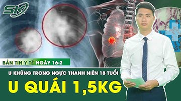 Bản Tin Y Tế 16/2: Phẫu Thuật Bóc Khối U Quái 1,5 Kg Khỏi Lồng Ngực Bệnh Nhân 18 Tuổi | SKĐS
