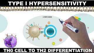 Type I Hypersensitivity  | Immediate Type