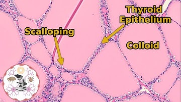 Thyroid & Parathyroid Histology: Don