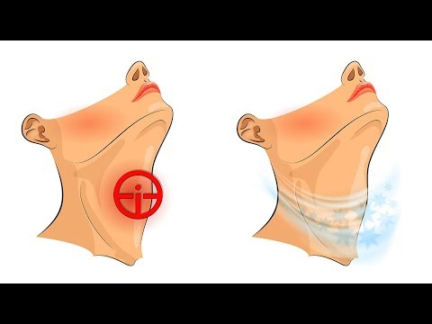 Video: 3 Möglichkeiten, um juckenden Hals zu lindern