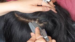 😴 ASMR Super Satisfying Scalp Scratching  Dandruff Removal for Instant Sleep D0286