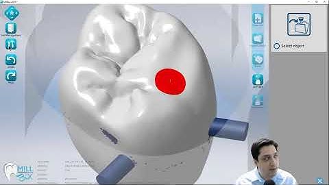 MillBox 2019 - Hybrid Abutment and Screw Retained Workflow