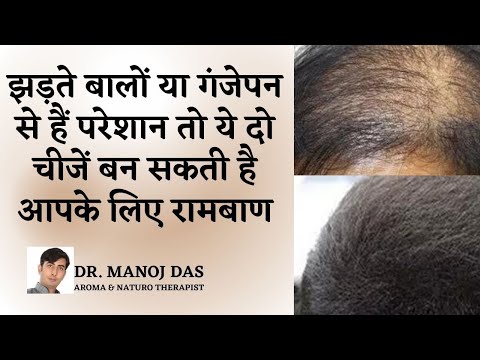 How to Stop Hair Fall and Grow Hair Faster Naturally (Men & Women) I DR. MANOJ DAS