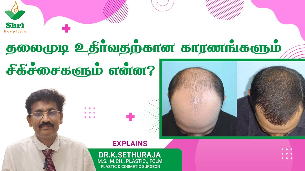 What are the causes and treatments for hair loss? Dr. K. Sethuraja