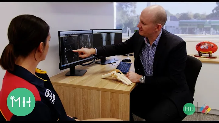 Do I need an ACL reconstruction?