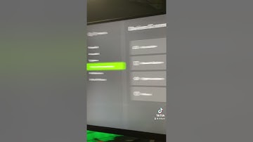 Open NAT Xbox Series X