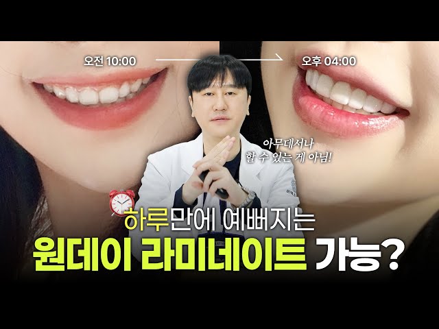 ✨당일 완성 가능한 원데이 라미네이트🦷 일반 라미네이트와 무슨 차이?