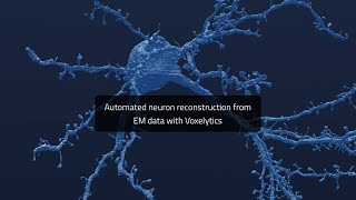Automated neuron reconstruction from EM data with Voxelytics