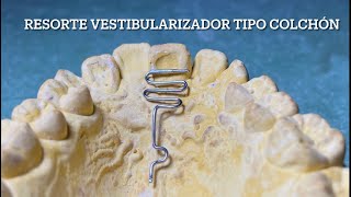 Resorte Vestibularizador Tipo Colchón