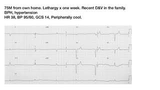 Prehospital Bradycardia Cases