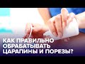 Чем обрабатывать ССАДИНЫ и ПОРЕЗЫ? Собираем АПТЕЧКУ