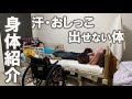 #180 【解説】首を骨折すると、どんな体になるの?【脊髄損傷】
