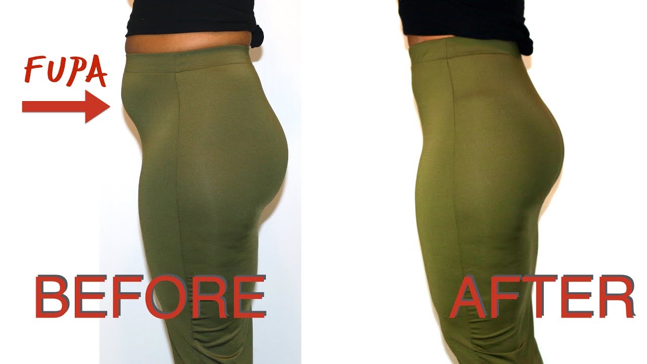 How To Hide My Fupa | Before And Afters