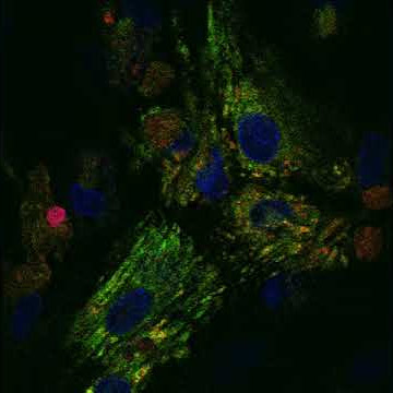 Contracting cardiomyocyte under confocal