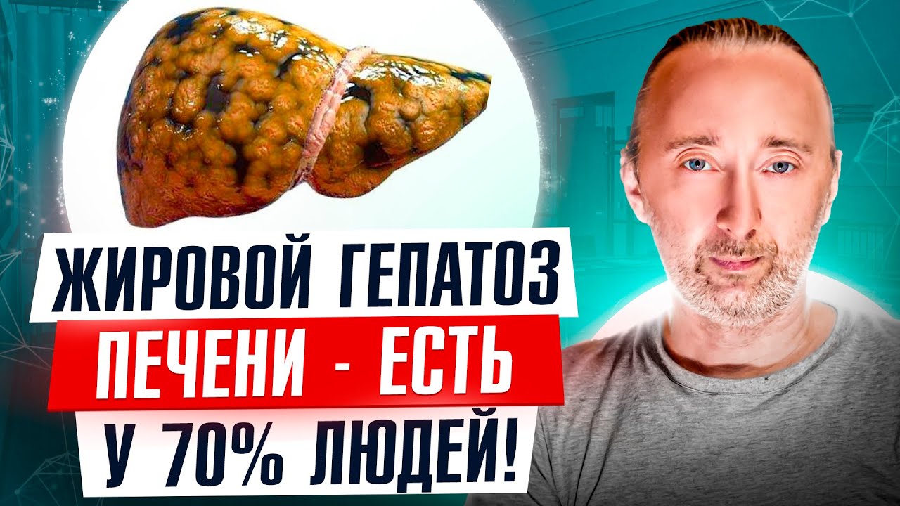 Вы знали, что у Вас УЖЕ жировой ГЕПАТОЗ Печени? Признаки, 5 причин, чем ...