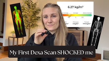 My first Dexa Scan Experience