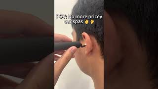 Minixtec EarSight Plus Review: Home Ear Wax Removal Kit 👂