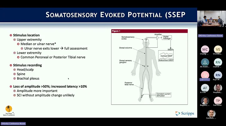 Intraoperative Neuromonitoring presented by Yusef Jordan, MD - February 17, 2025