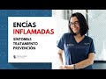 Encías inflamadas: síntomas, tratamiento y prevención.