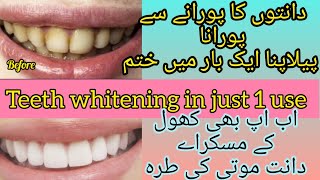 teeth whitening at homewho to get rid of yellow stan of teeth in 1 useدانت چاندی کی طرہ چمکدار