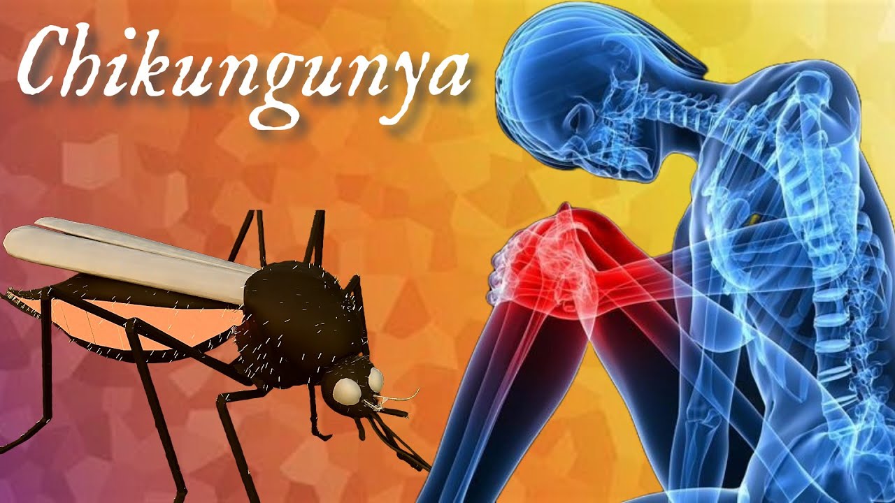 Chikungunya pathology lectures pathology youtube